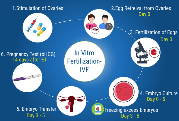 IVF procedure in India