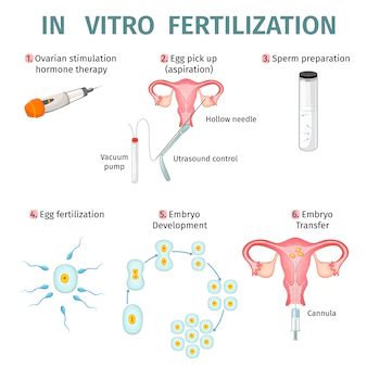 IVF Treatment in Congo 